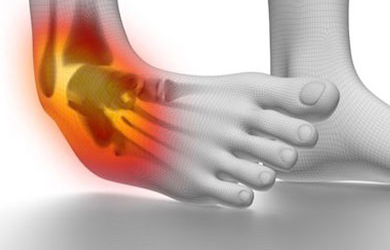 足関節捻挫にて関節可動域を超え捻挫ではなく骨折をする可能性を説明している画像