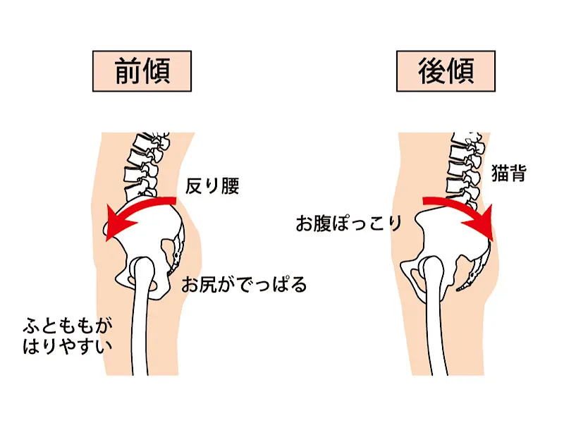 グロインペインと体幹機能（骨盤運動）の関係について説明をしている写真