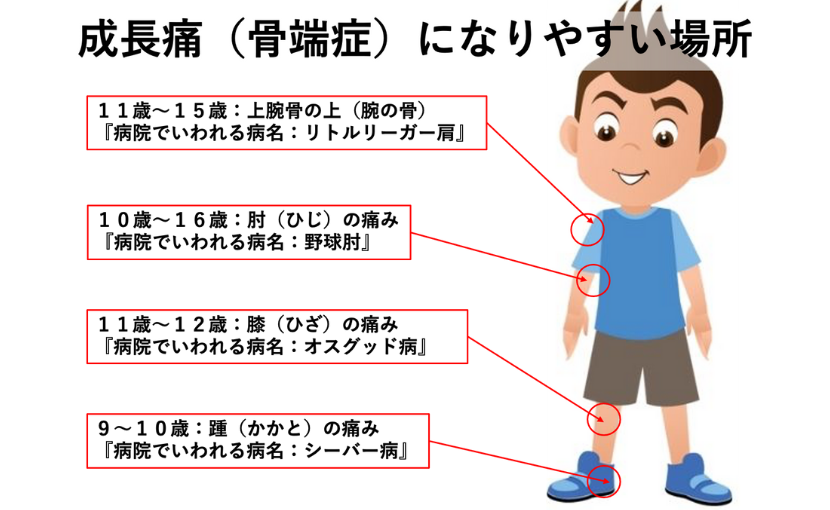 肩や肘、膝、踵の骨端症の説明をしている写真