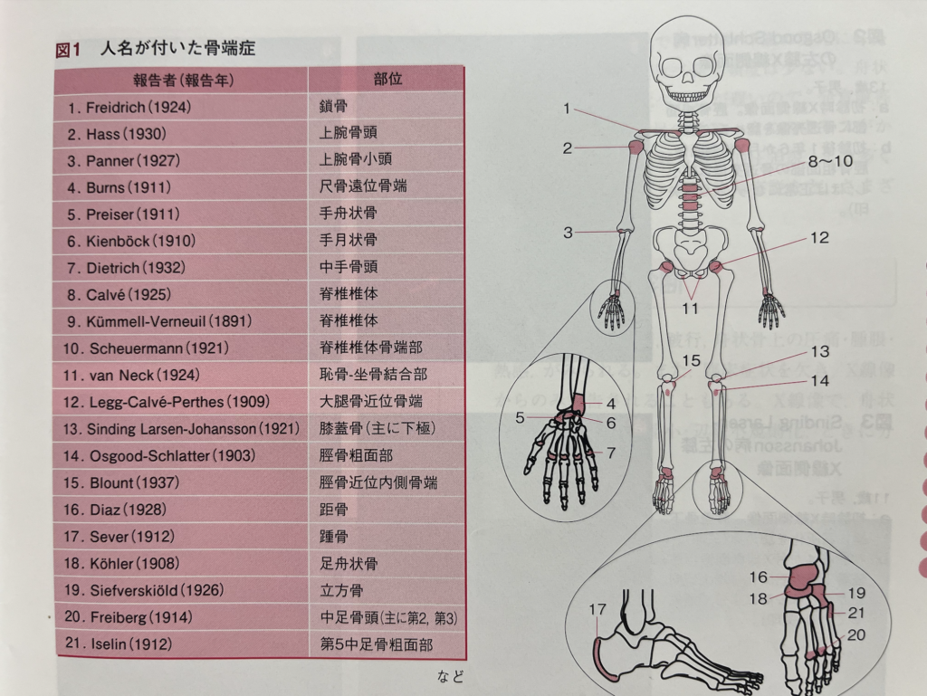 成長期の子どもに起こる骨端症について説明をしている写真