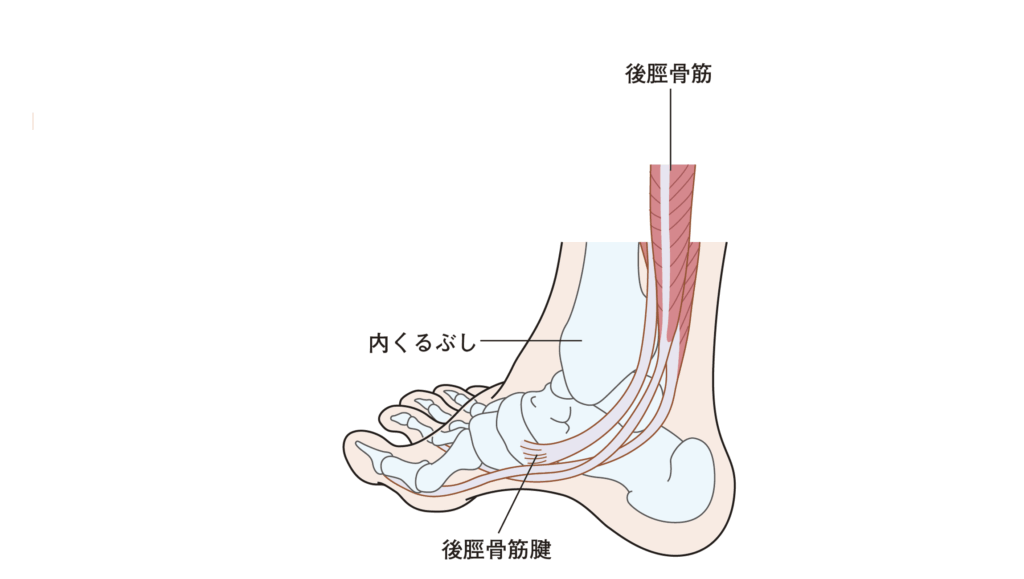 足首の痛み（後脛骨筋腱炎）について説明をしている写真