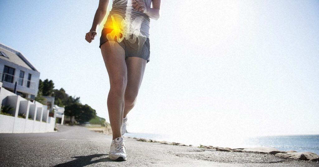 ランニング中に股関節に痛みが起こった時の写真