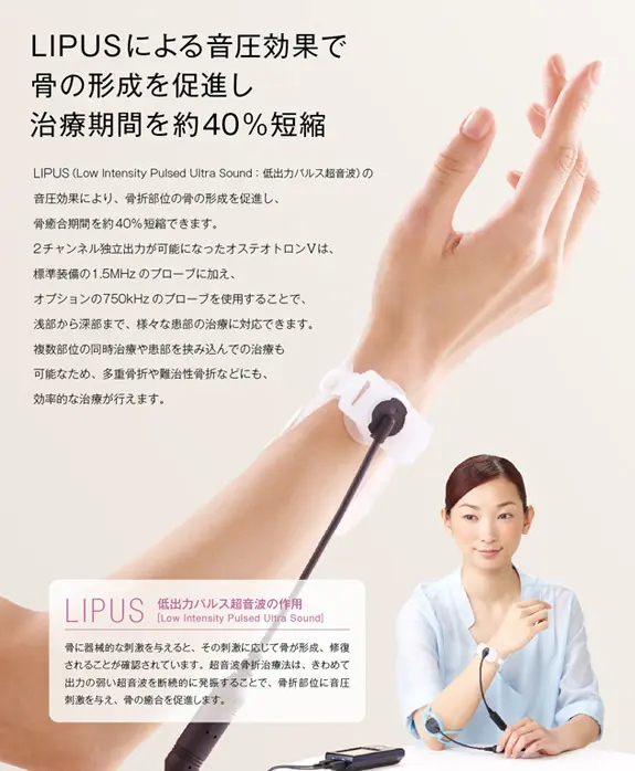 治療期間を短期間で治すことができる医療機器の説明をしている写真。