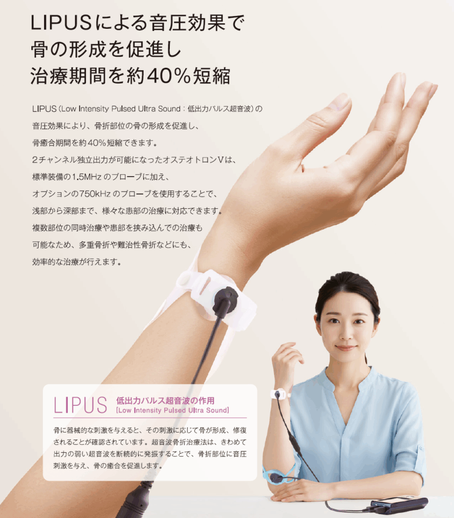 低出力超音波治療器(LIPUS)について説明をしている写真。