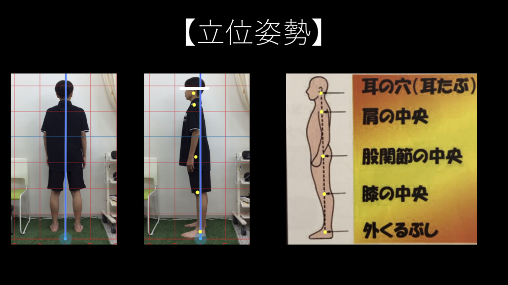 フィジカルチェック（運動機能検査）にて、姿勢の検査をしている時の写真。
