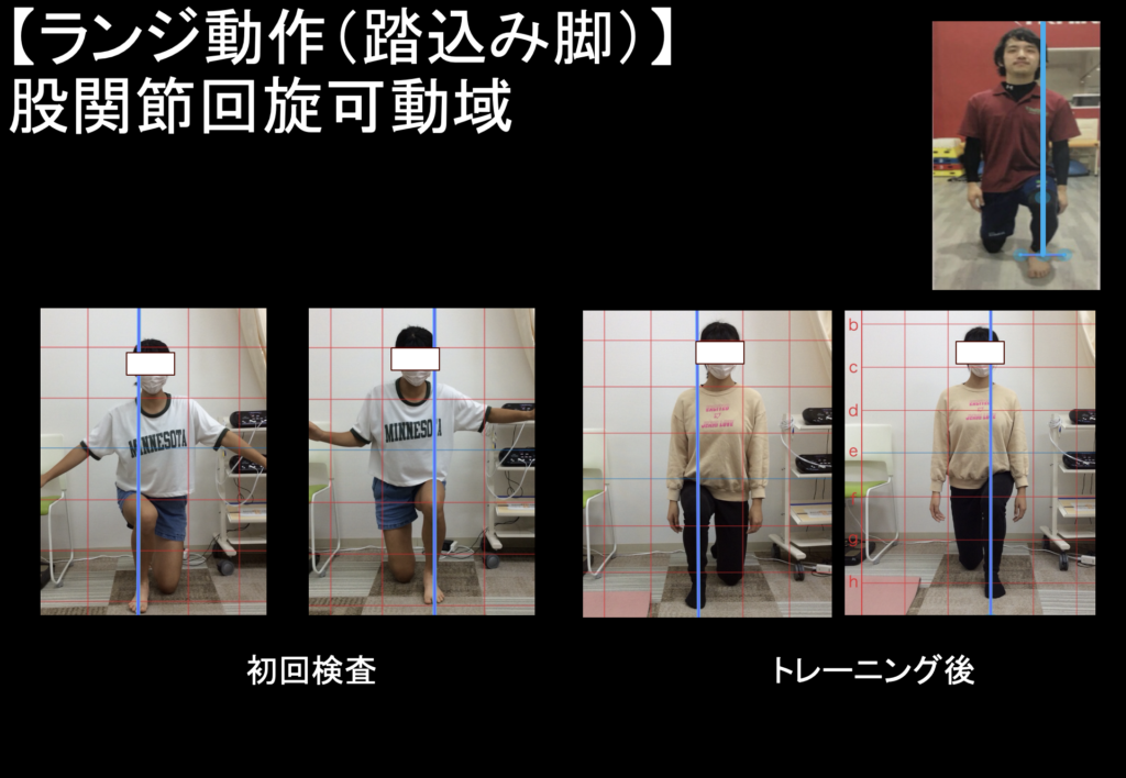 トレーニング前後の股関節の可動域の変化を比較している写真。
