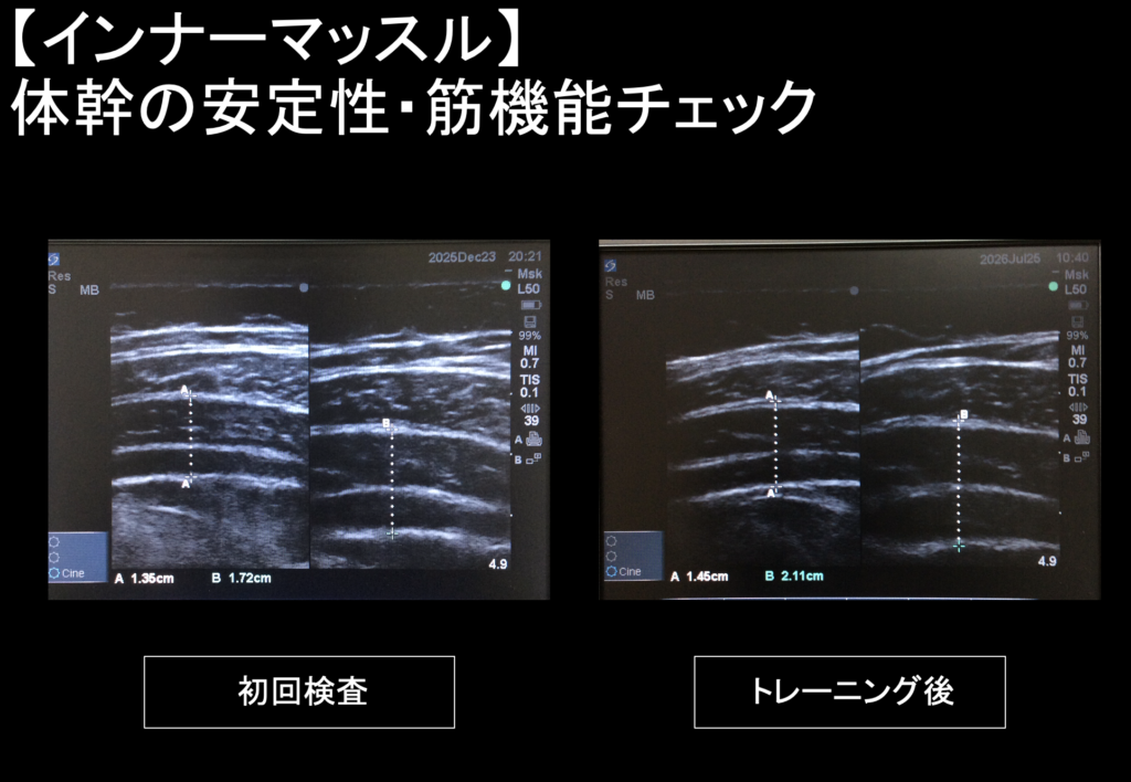 トレーニング前後の体幹機能の変化を比較している写真。